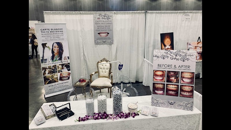 Carte Blanche Teeth Whitening