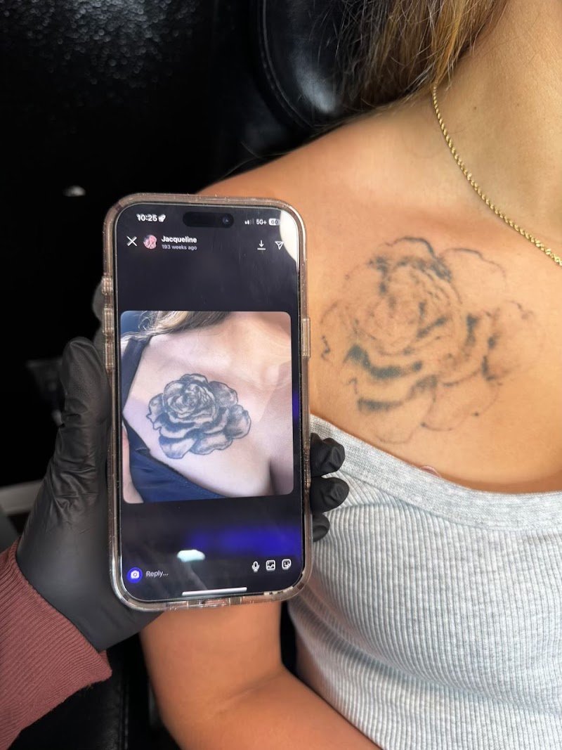 Dtown Laser Tattoo Removal & Aesthetics,LLC photo 3