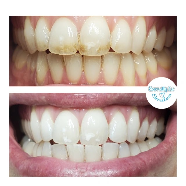 Eternally Lit Smiles llc