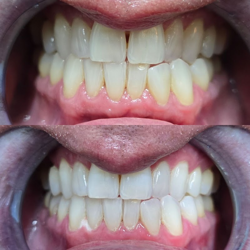 Gems Teeth Whitening photo 2