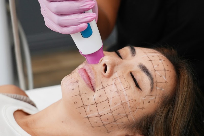 LaserAway Tampa Heights photo 3