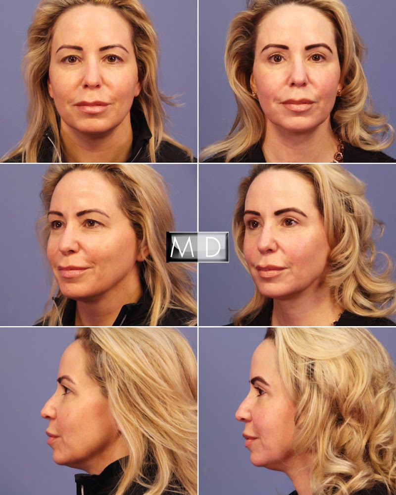 Lemmon Avenue Plastic Surgery and Laser Center