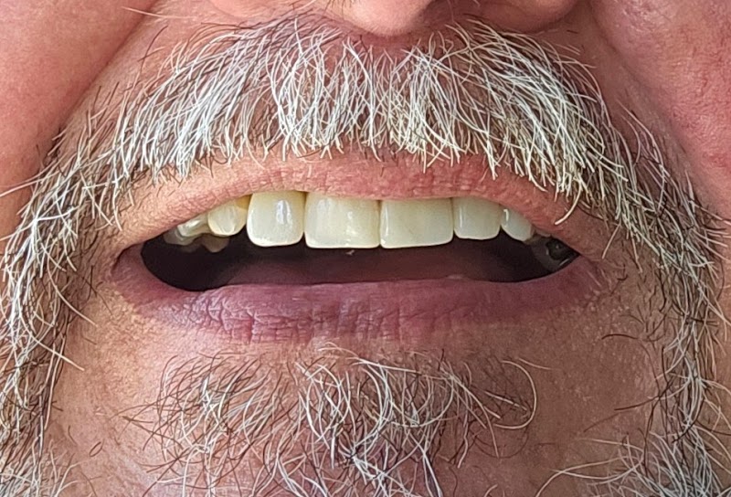 North Pointe Dental of North Tampa photo 3