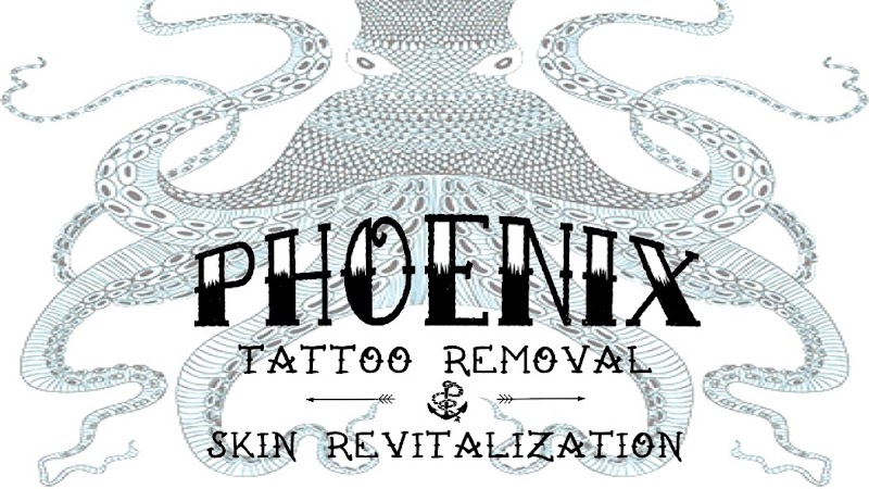 Phoenix Tattoo Removal and Skin Revitalization