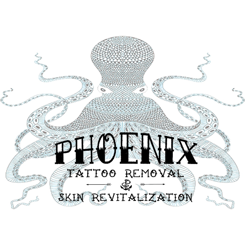 Phoenix Tattoo Removal and Skin Revitalization photo 2