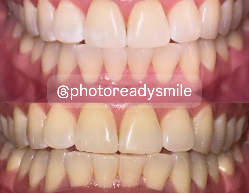 Photo Ready Smile photo 2