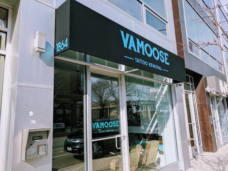 Removery Tattoo Removal & Fading photo 3