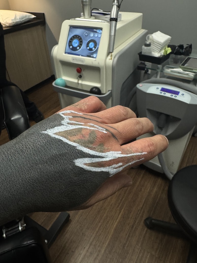 Removery Tattoo Removal & Fading photo 3