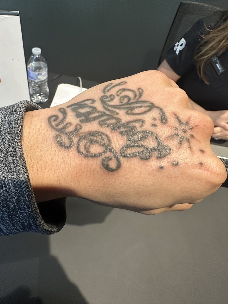 Removery Tattoo Removal & Fading photo 3