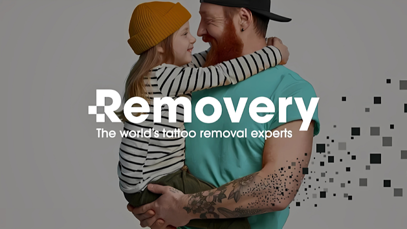 Removery Tattoo Removal & Fading