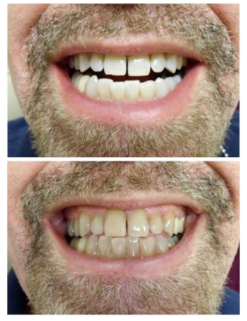 Teeth Whitening Experts NYC photo 3