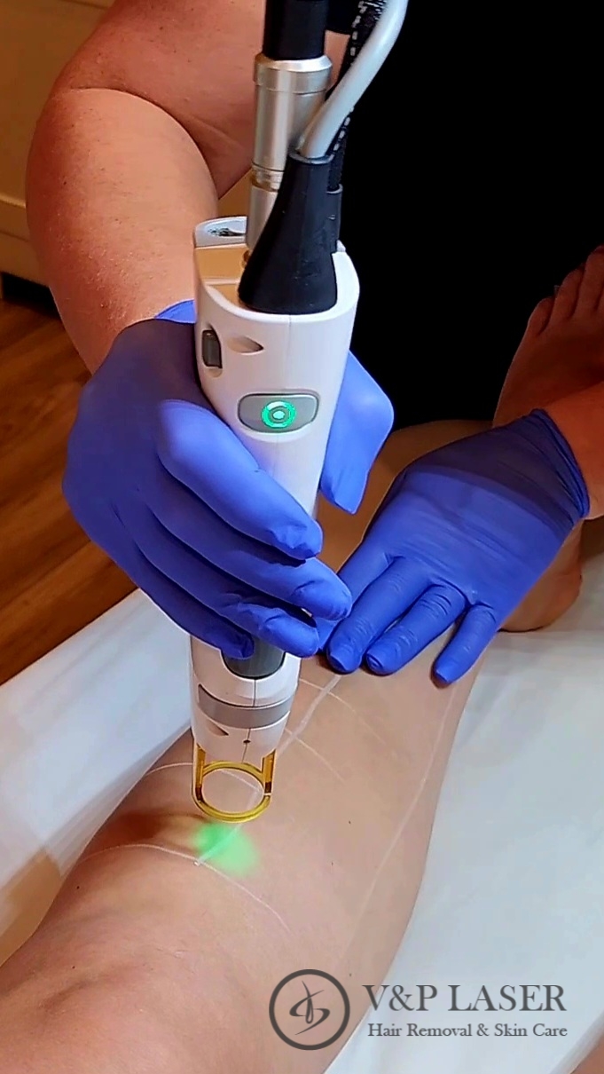 V&P Laser Hair Removal & Skin Care photo 2