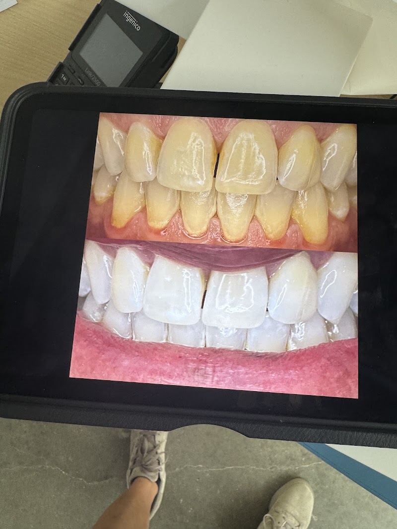 We Whiten Teeth Whitening photo 3