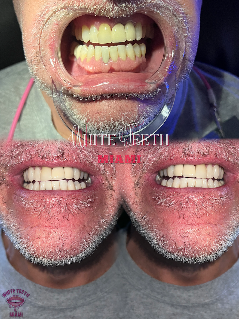 White Teeth Miami photo 2