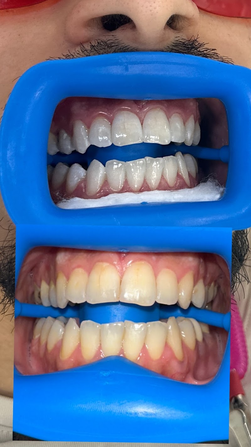 Whitening Bar NYC