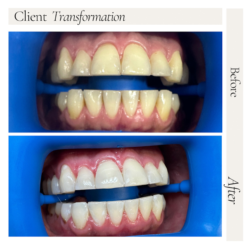 Whitening Bar NYC photo 2