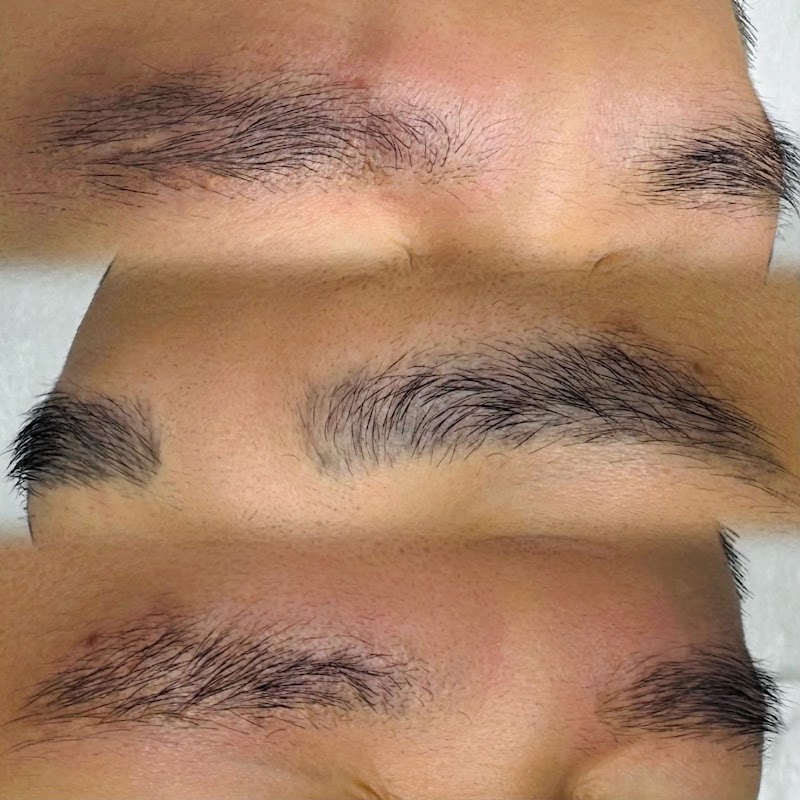 WOW LASER NYC Tattoo removal in New York photo 3